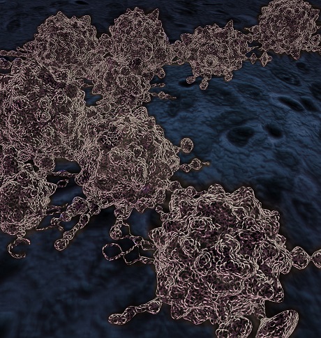 Image of Cancer cells